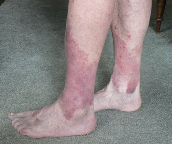 What Best Describes Your Condition? *