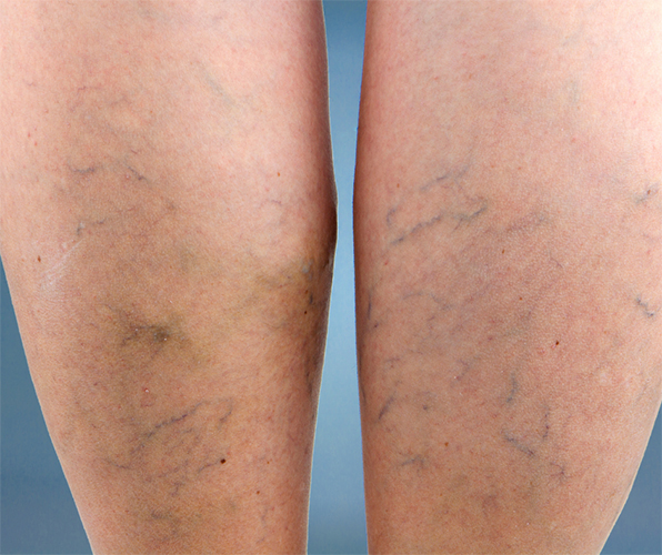 What Best Describes Your Condition? *