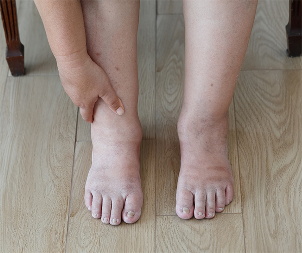 What Best Describes Your Condition? *