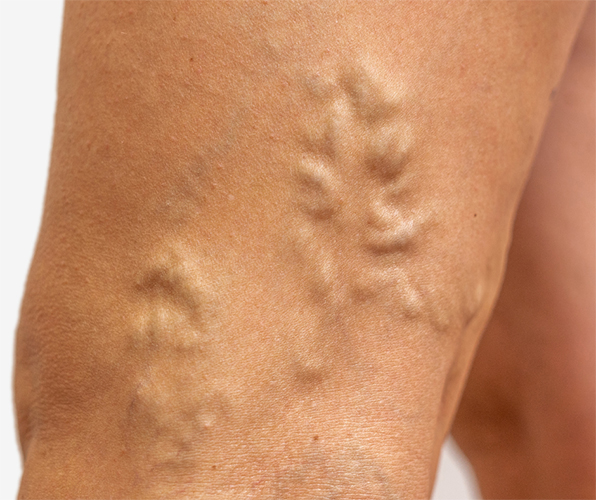 What Best Describes Your Condition? *
